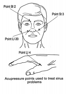 sinus image protraying sinus pressure points